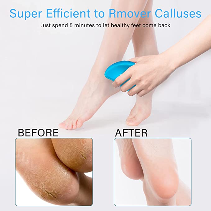 Canvalite Glass Foot File Callus Remover for Feet (1 Pack)