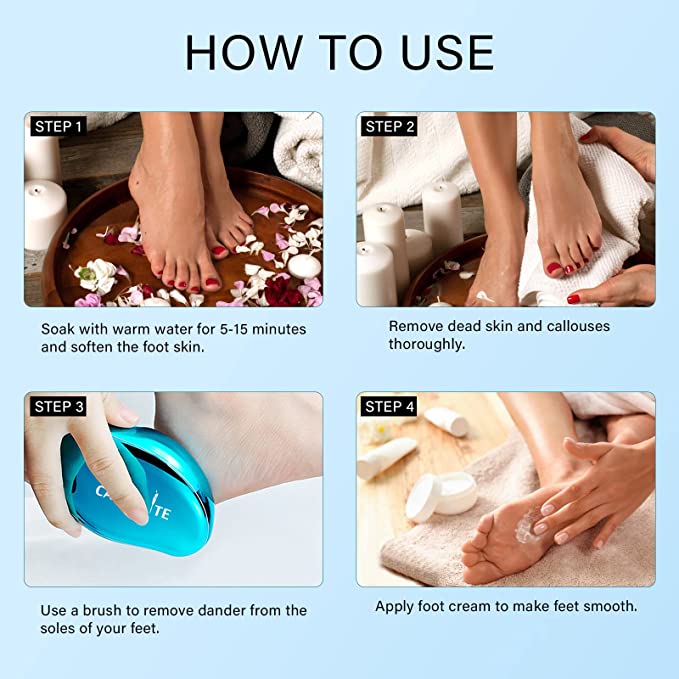 How To Remove Dead Skin From The Soles Of Your Feet - Utama Spice
